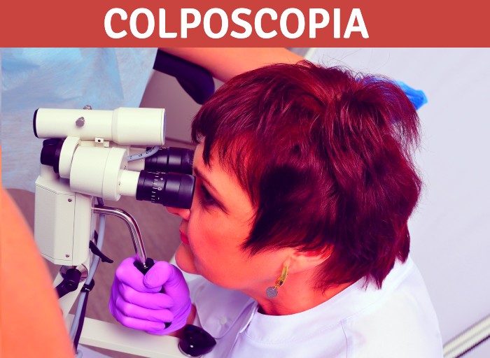 ¿Qué es una colposcopia y cuándo se debe hacer?