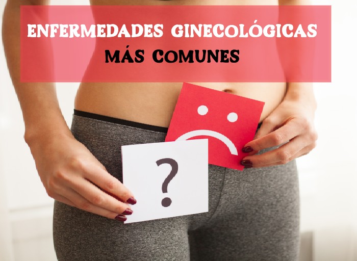 ¿Cuáles son los problemas ginecológicos más comunes?