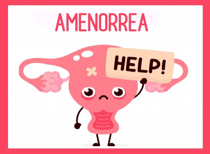 Amenorrea ¿Qué es? ¿Cuál es su causa? ¿Y su tratamiento?