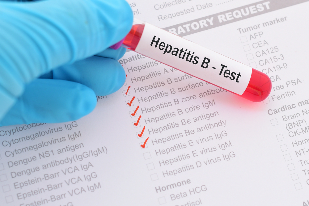 ¿Qué es la Hepatitis B?