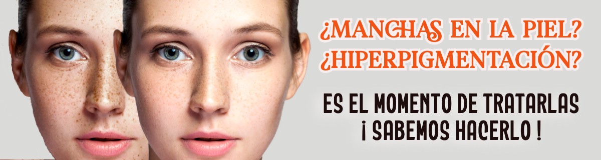 Hiperpigmentación de la piel 